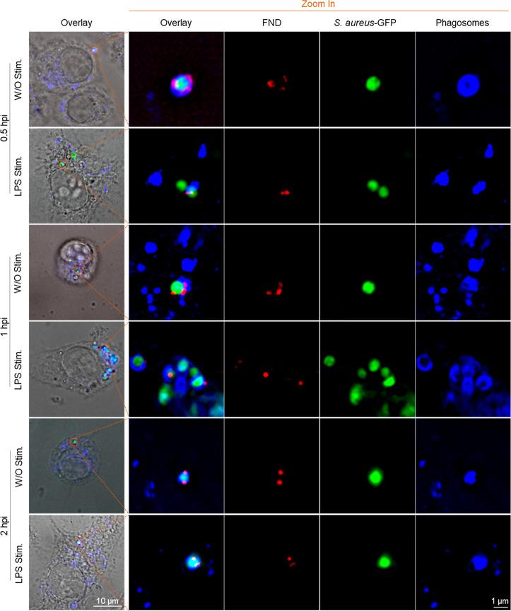 https://cdn.ncbi.nlm.nih.gov/pmc/blobs/506d/9878971/ee761353a590/nn2c08190_0003.jpg