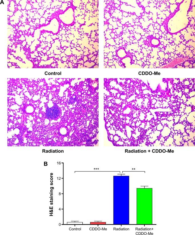 https://cdn.ncbi.nlm.nih.gov/pmc/blobs/506e/4482372/7e352a24971e/dddt-9-3163Fig3.jpg