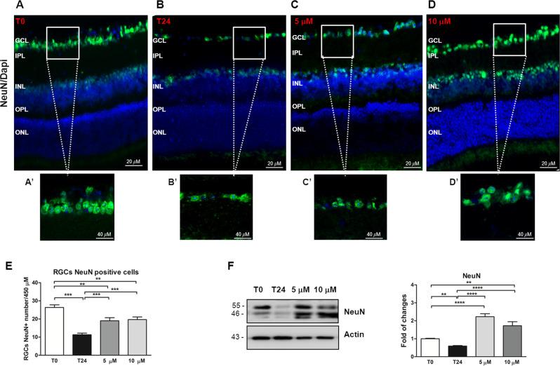 https://cdn.ncbi.nlm.nih.gov/pmc/blobs/5070/8674341/1c0f3f9a2771/41420_2021_760_Fig4_HTML.jpg