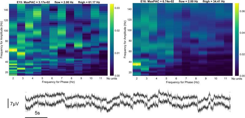 https://cdn.ncbi.nlm.nih.gov/pmc/blobs/5070/9730545/9dc5da310041/j_tnsci-2022-0256-fig008.jpg