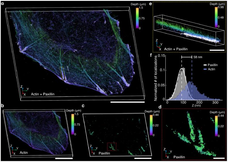https://cdn.ncbi.nlm.nih.gov/pmc/blobs/5071/11161355/81e60fed09bc/boe-15-5-3050-g004.jpg