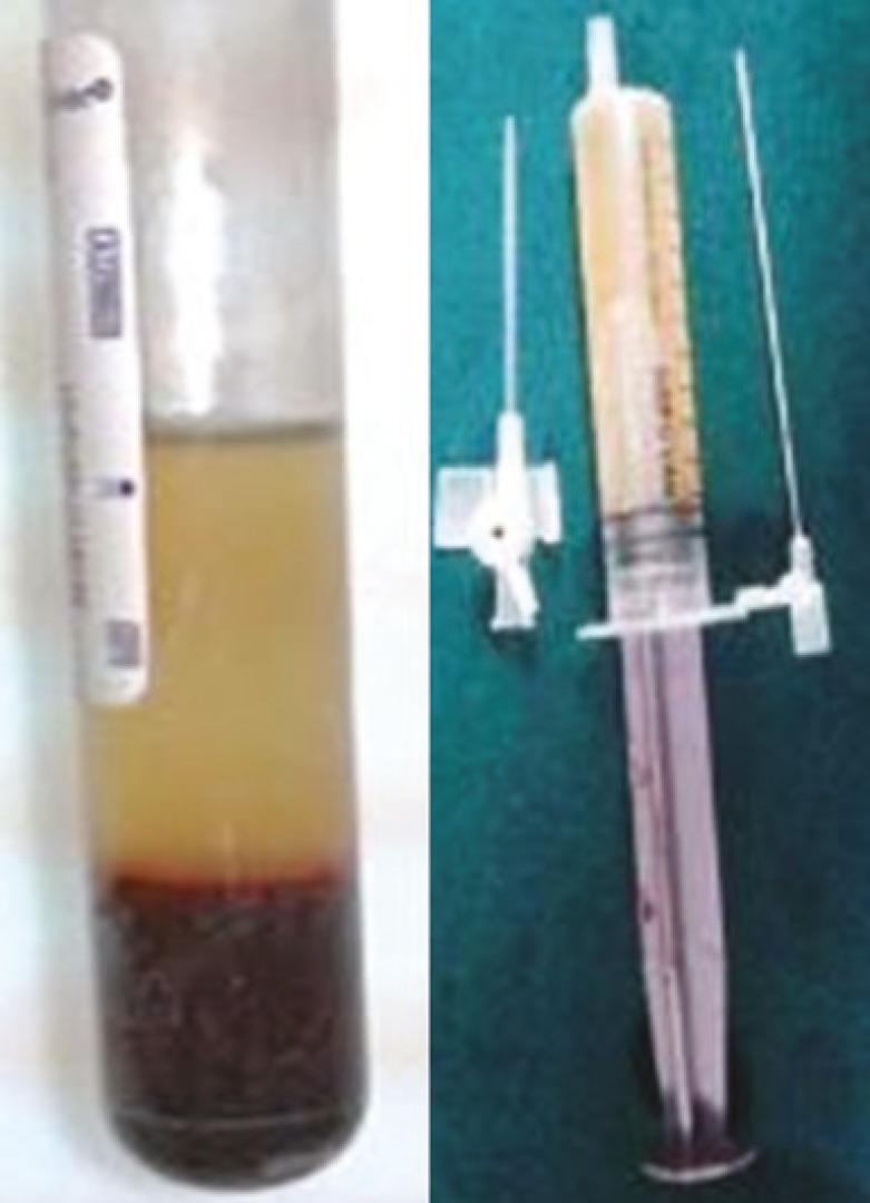 https://cdn.ncbi.nlm.nih.gov/pmc/blobs/507a/4298865/08e826d08a5e/wjps-4-050-g001.jpg