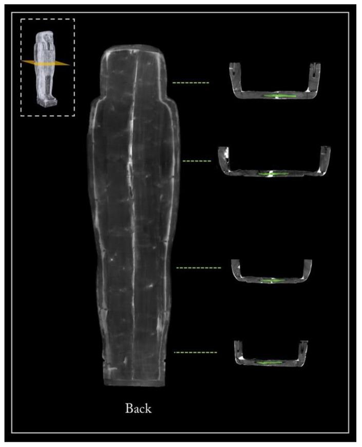 https://cdn.ncbi.nlm.nih.gov/pmc/blobs/5085/8879447/03195579fa51/jimaging-08-00039-g006.jpg
