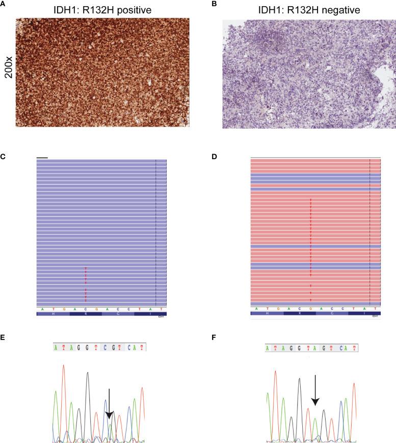 https://cdn.ncbi.nlm.nih.gov/pmc/blobs/5088/8969903/42e69c9ee06e/fonc-12-861078-g002.jpg
