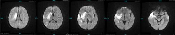 https://cdn.ncbi.nlm.nih.gov/pmc/blobs/5089/3707746/6273c300433f/1752-1947-7-179-1.jpg