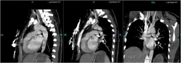 https://cdn.ncbi.nlm.nih.gov/pmc/blobs/5089/3707746/d92f4238dc5e/1752-1947-7-179-3.jpg