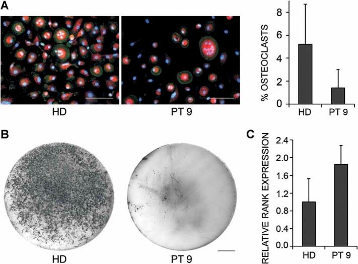 https://cdn.ncbi.nlm.nih.gov/pmc/blobs/508a/3306792/1d235765b470/jbmr0027-0342-f2.jpg