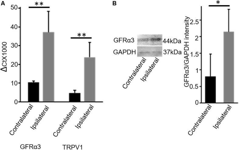 https://cdn.ncbi.nlm.nih.gov/pmc/blobs/508e/7031206/fa0abfda7e60/fnins-14-00077-g001.jpg