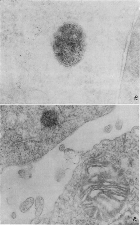https://cdn.ncbi.nlm.nih.gov/pmc/blobs/5092/2041387/87c8132efc33/brjexppathol00131-0055-b.jpg
