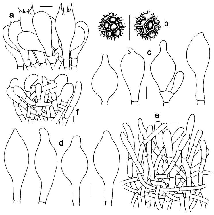 https://cdn.ncbi.nlm.nih.gov/pmc/blobs/5093/10744113/03575a9c7ef1/jof-09-01128-g005.jpg