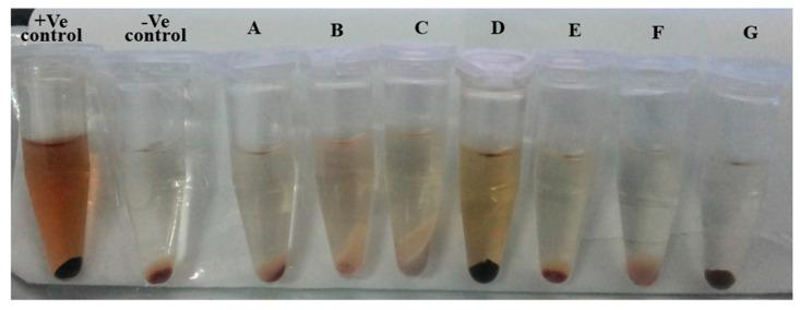 https://cdn.ncbi.nlm.nih.gov/pmc/blobs/5093/8196732/22696c418420/ijms-22-05433-g019.jpg