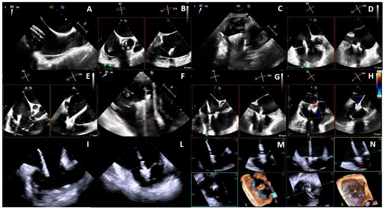 https://cdn.ncbi.nlm.nih.gov/pmc/blobs/5094/11508844/b4ffed99d0f6/jcm-13-06144-g006.jpg