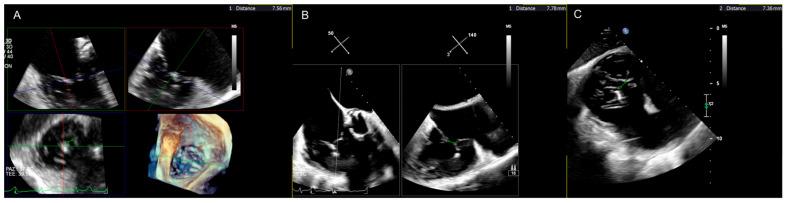 https://cdn.ncbi.nlm.nih.gov/pmc/blobs/5094/11508844/e9640bfb82a3/jcm-13-06144-g003.jpg