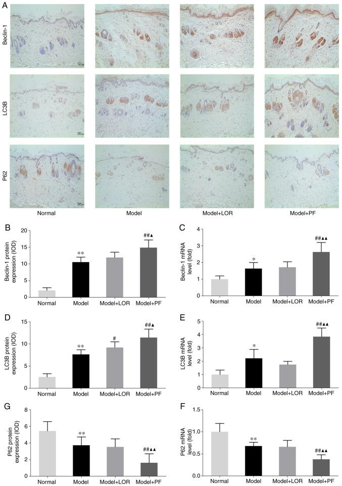 https://cdn.ncbi.nlm.nih.gov/pmc/blobs/5094/8056118/1ec02f319270/etm-21-06-10022-g05.jpg