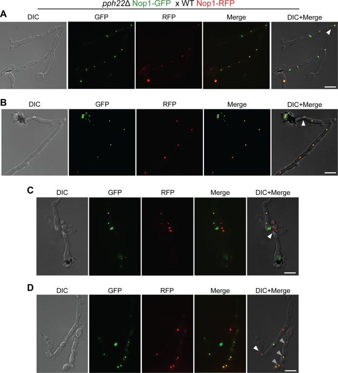 https://cdn.ncbi.nlm.nih.gov/pmc/blobs/50a2/12240305/eaa12ce8dec7/pgen.1011774.g003.jpg