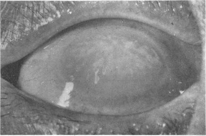 https://cdn.ncbi.nlm.nih.gov/pmc/blobs/50a6/1039491/053edda9c2c1/brjopthal00184-0042-a.jpg