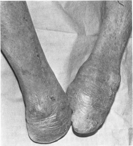 https://cdn.ncbi.nlm.nih.gov/pmc/blobs/50a6/1039491/06e5a74a7fb3/brjopthal00184-0040-a.jpg