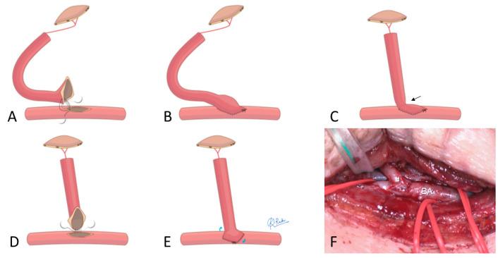 https://cdn.ncbi.nlm.nih.gov/pmc/blobs/50aa/11857833/bd9001de607d/medicina-61-00295-g002.jpg