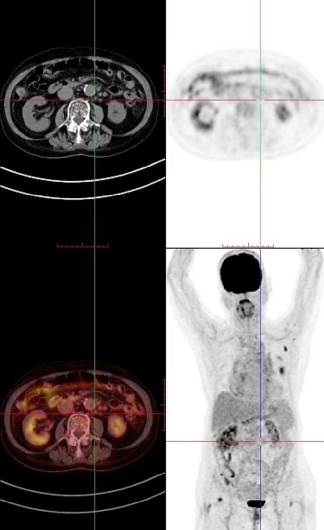 https://cdn.ncbi.nlm.nih.gov/pmc/blobs/50aa/12256661/96ae0ef4f4de/CCR3-13-e70617-g003.jpg