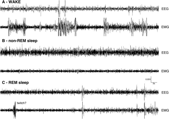 https://cdn.ncbi.nlm.nih.gov/pmc/blobs/50b5/8211919/916104f64d21/gr1.jpg