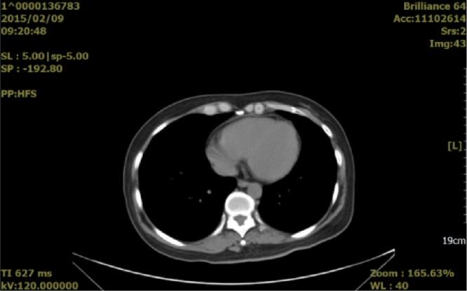 https://cdn.ncbi.nlm.nih.gov/pmc/blobs/50bb/4599051/e18e9ada8dc8/ott-8-2767Fig2.jpg
