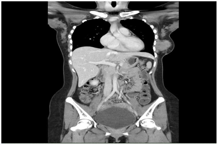 https://cdn.ncbi.nlm.nih.gov/pmc/blobs/50c0/11222410/a579f7ac12b2/fonc-14-1377074-g002.jpg