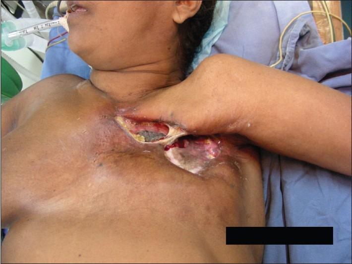 https://cdn.ncbi.nlm.nih.gov/pmc/blobs/50c7/3495383/3d1f18d4bee9/IJPS-45-325-g002.jpg