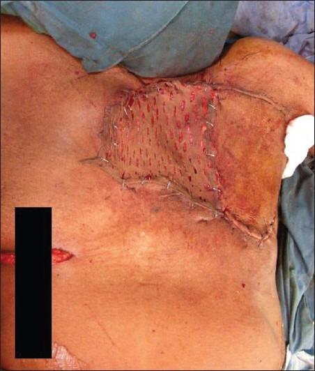 https://cdn.ncbi.nlm.nih.gov/pmc/blobs/50c7/3495383/9dd3bad36e71/IJPS-45-325-g005.jpg