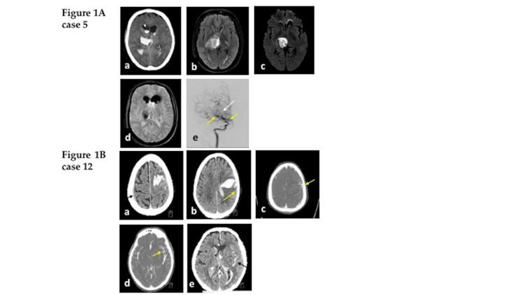 https://cdn.ncbi.nlm.nih.gov/pmc/blobs/50c9/10858811/ddf0633a568e/cureus-0016-00000052128-i01.jpg