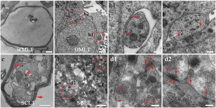 https://cdn.ncbi.nlm.nih.gov/pmc/blobs/50c9/6145267/c159d834dc1b/ADVS-5-1800261-g002.jpg