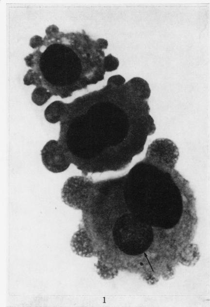 https://cdn.ncbi.nlm.nih.gov/pmc/blobs/50ce/2008861/1146f2915055/brjcancer00361-0199-a.jpg