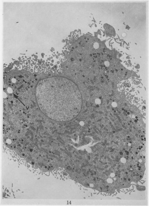 https://cdn.ncbi.nlm.nih.gov/pmc/blobs/50ce/2008861/2d5284a92274/brjcancer00361-0208-a.jpg