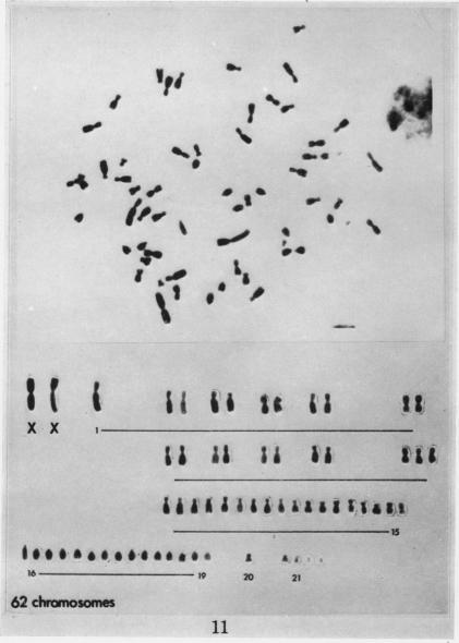 https://cdn.ncbi.nlm.nih.gov/pmc/blobs/50ce/2008861/8c84e75502e7/brjcancer00361-0205-a.jpg