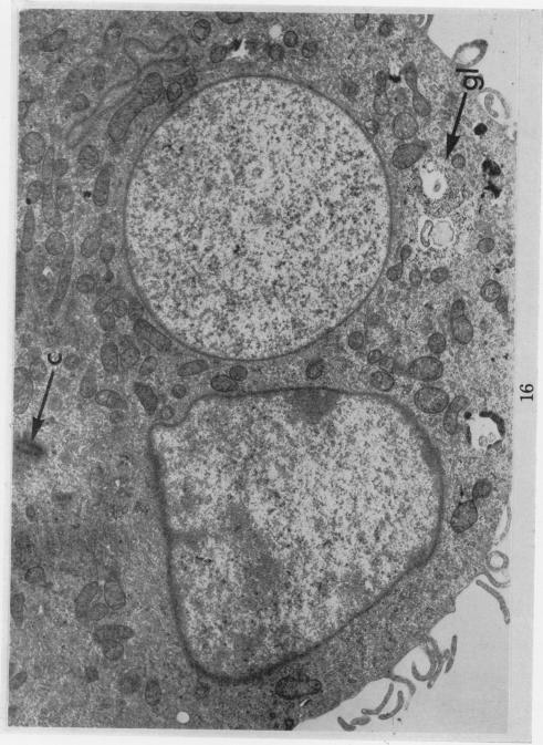 https://cdn.ncbi.nlm.nih.gov/pmc/blobs/50ce/2008861/fe36c6bfe52e/brjcancer00361-0210-a.jpg