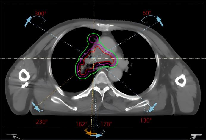https://cdn.ncbi.nlm.nih.gov/pmc/blobs/50d0/12333610/cda87020d23c/peerj-13-19831-g001.jpg