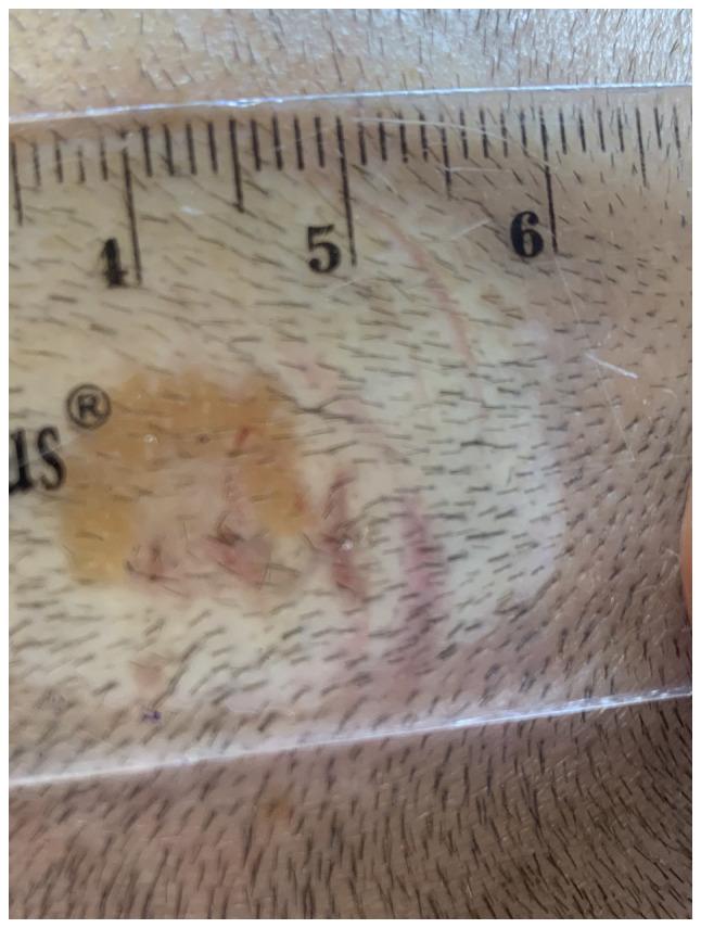 https://cdn.ncbi.nlm.nih.gov/pmc/blobs/50d7/8515547/3bba82b4b67c/etm-22-06-10803-g02.jpg