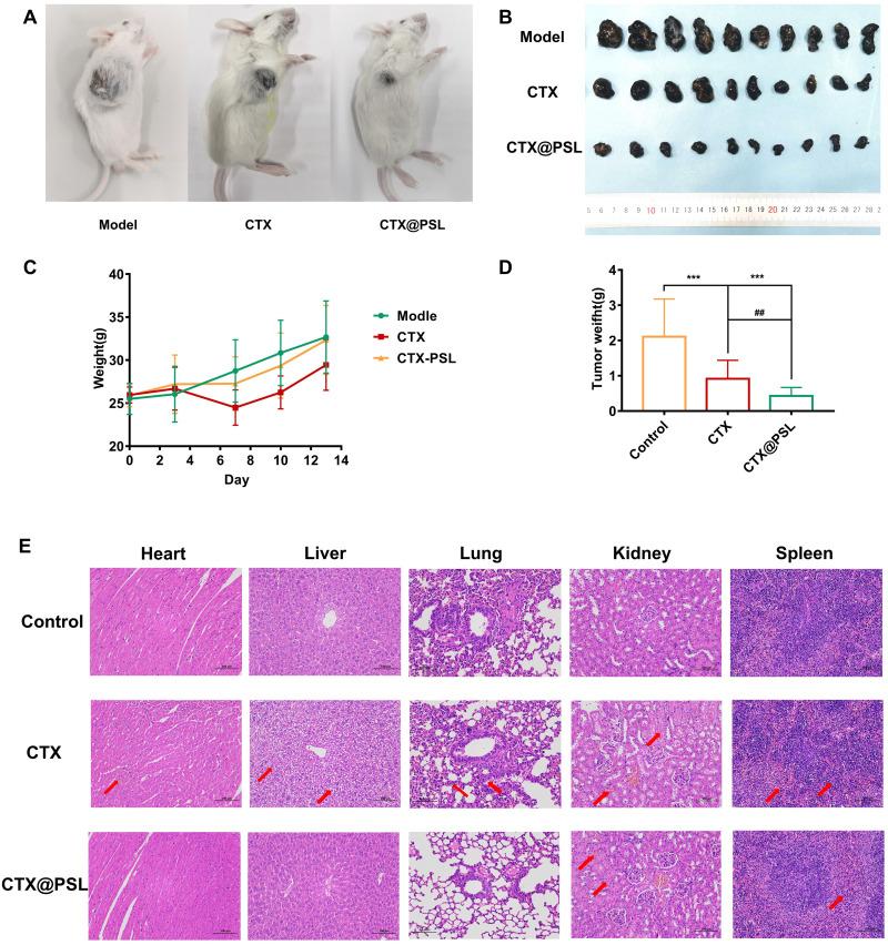 https://cdn.ncbi.nlm.nih.gov/pmc/blobs/50e2/11164093/4e41e8dab487/IJN-19-5381-g0006.jpg