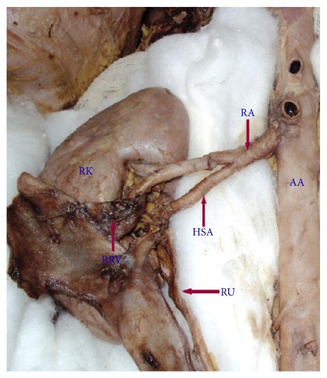 https://cdn.ncbi.nlm.nih.gov/pmc/blobs/50e6/4392953/c26c6df5efb5/ISRN.ANATOMY2013-405712.002.jpg