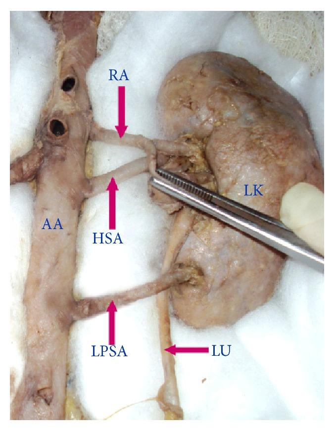 https://cdn.ncbi.nlm.nih.gov/pmc/blobs/50e6/4392953/c6a4d2487fd6/ISRN.ANATOMY2013-405712.005.jpg