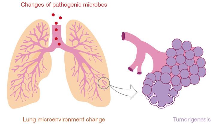 https://cdn.ncbi.nlm.nih.gov/pmc/blobs/50e6/8904948/34b01aebb63f/tcr-11-02-426-f4.jpg