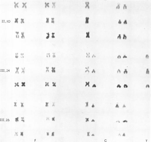 https://cdn.ncbi.nlm.nih.gov/pmc/blobs/50e8/1013059/a7531c6243ba/jmedgene00325-0065-a.jpg