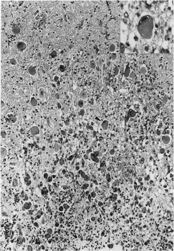 https://cdn.ncbi.nlm.nih.gov/pmc/blobs/50ed/2589229/d0f270f218e6/yjbm00068-0134-a.jpg