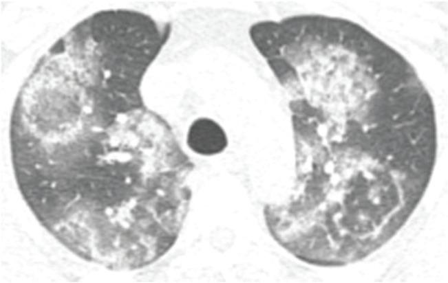 https://cdn.ncbi.nlm.nih.gov/pmc/blobs/50ef/7297525/26adeb88c1c8/cln-75-e2027-g007.jpg