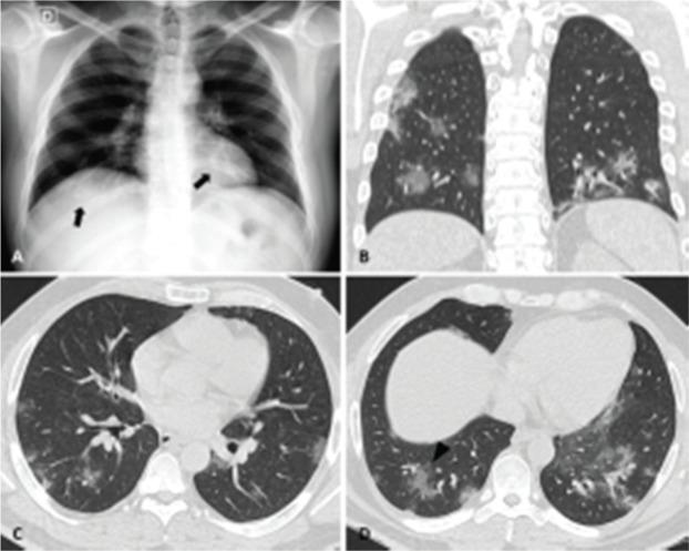https://cdn.ncbi.nlm.nih.gov/pmc/blobs/50ef/7297525/5f232667caf2/cln-75-e2027-g002.jpg