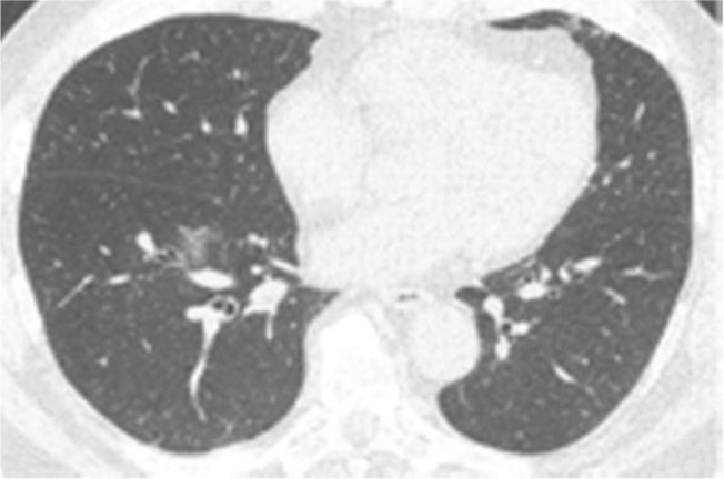https://cdn.ncbi.nlm.nih.gov/pmc/blobs/50ef/7297525/b7c102b613f5/cln-75-e2027-g10.jpg