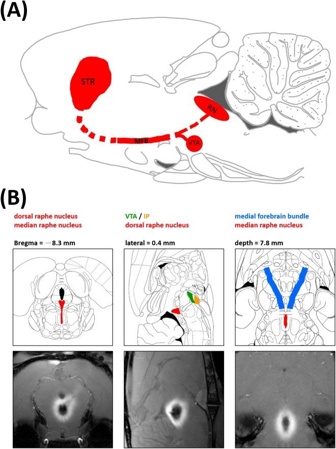 https://cdn.ncbi.nlm.nih.gov/pmc/blobs/50f1/4574734/812dc6f1c464/pone.0138431.g002.jpg