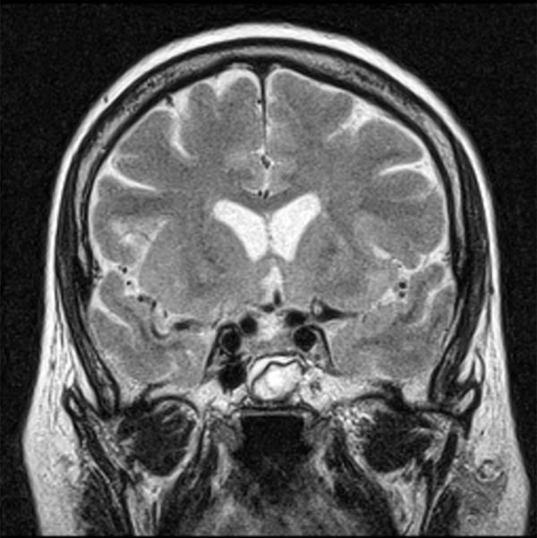 https://cdn.ncbi.nlm.nih.gov/pmc/blobs/50f3/3539462/059361b79992/medscimonit-17-10-MT83-g012.jpg