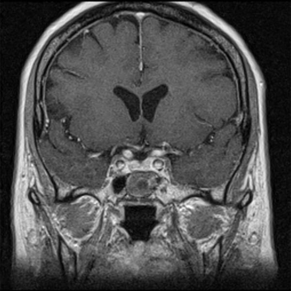 https://cdn.ncbi.nlm.nih.gov/pmc/blobs/50f3/3539462/82ef72314454/medscimonit-17-10-MT83-g011.jpg