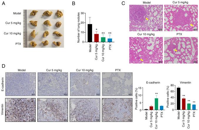 https://cdn.ncbi.nlm.nih.gov/pmc/blobs/50f8/12121984/9947b54124b6/ijmm-56-01-05552-g04.jpg