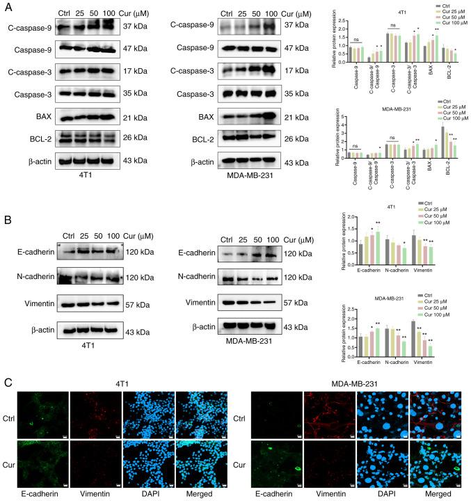 https://cdn.ncbi.nlm.nih.gov/pmc/blobs/50f8/12121984/ecfdc2bd5043/ijmm-56-01-05552-g02.jpg